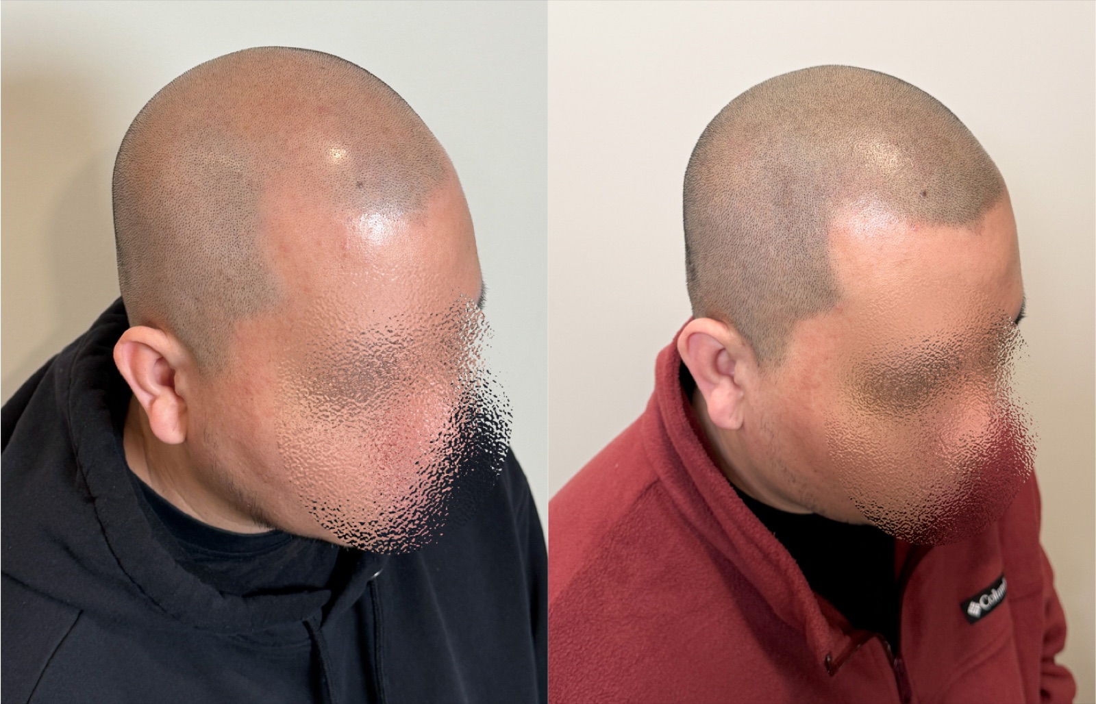 Shaved look SMP portfolio 24